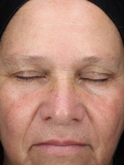 Close up of face after using product